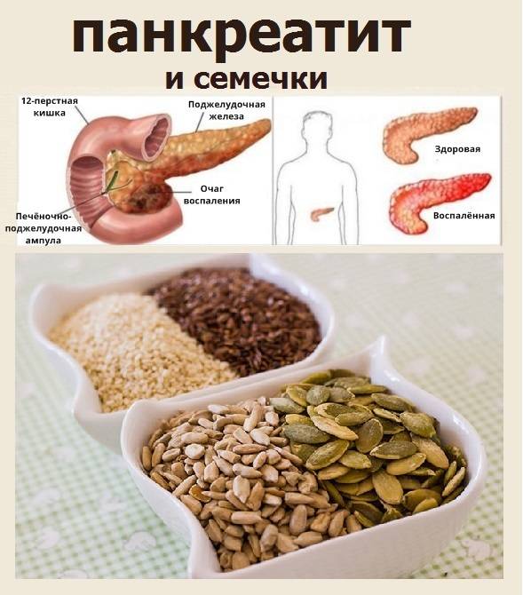 Тыква при панкреатите: правила приема и блюда во время болезни